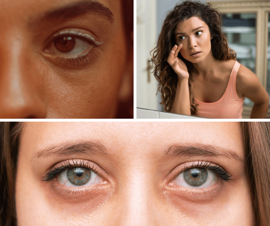 Oční krém — pro všechny typy pleti